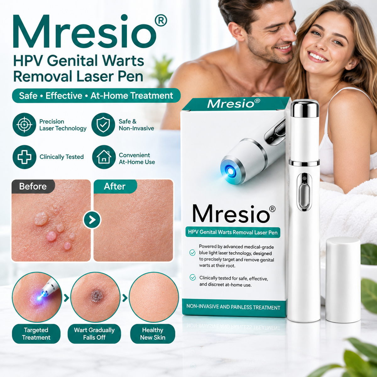Mresio® HPV Genital Warts Removal Laser Pen