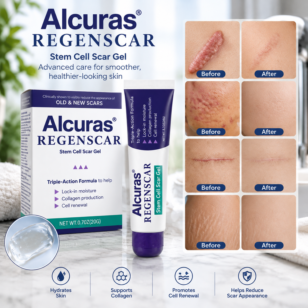 Alcuras® ReGenScar Stem Cell Scar Gel