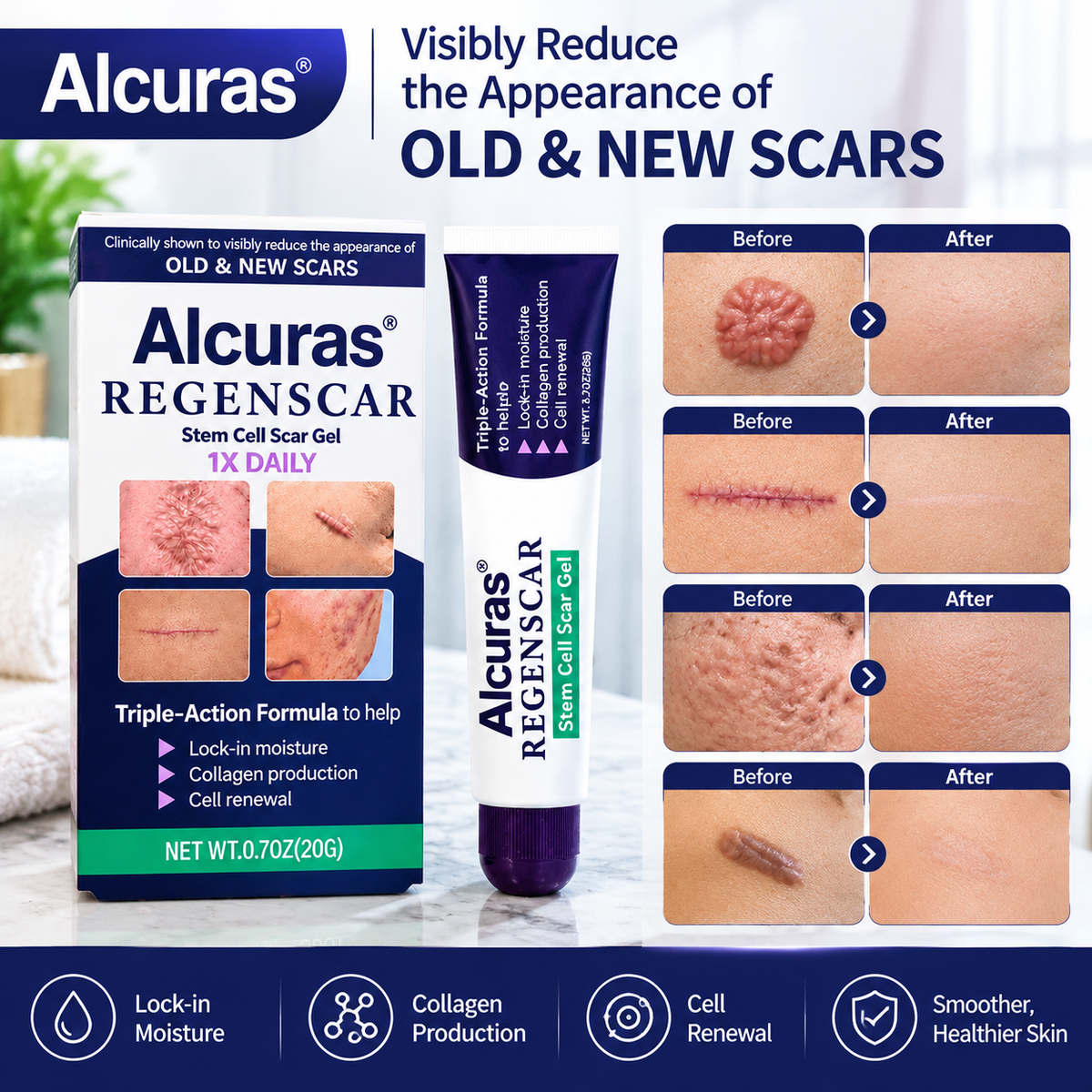 Alcuras® ReGenScar Stem Cell Scar Gel