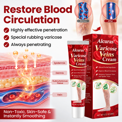 Alcuras® Varicose & Spider Vein Relief Cream