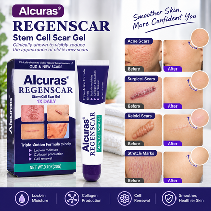 Alcuras® ReGenScar Stem Cell Scar Gel