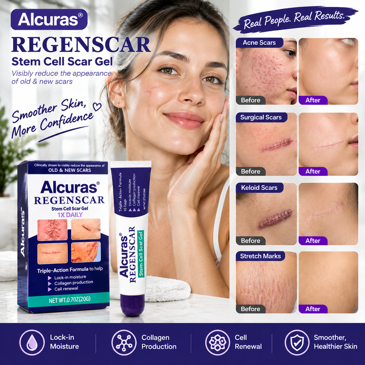 Alcuras® ReGenScar Stem Cell Scar Gel