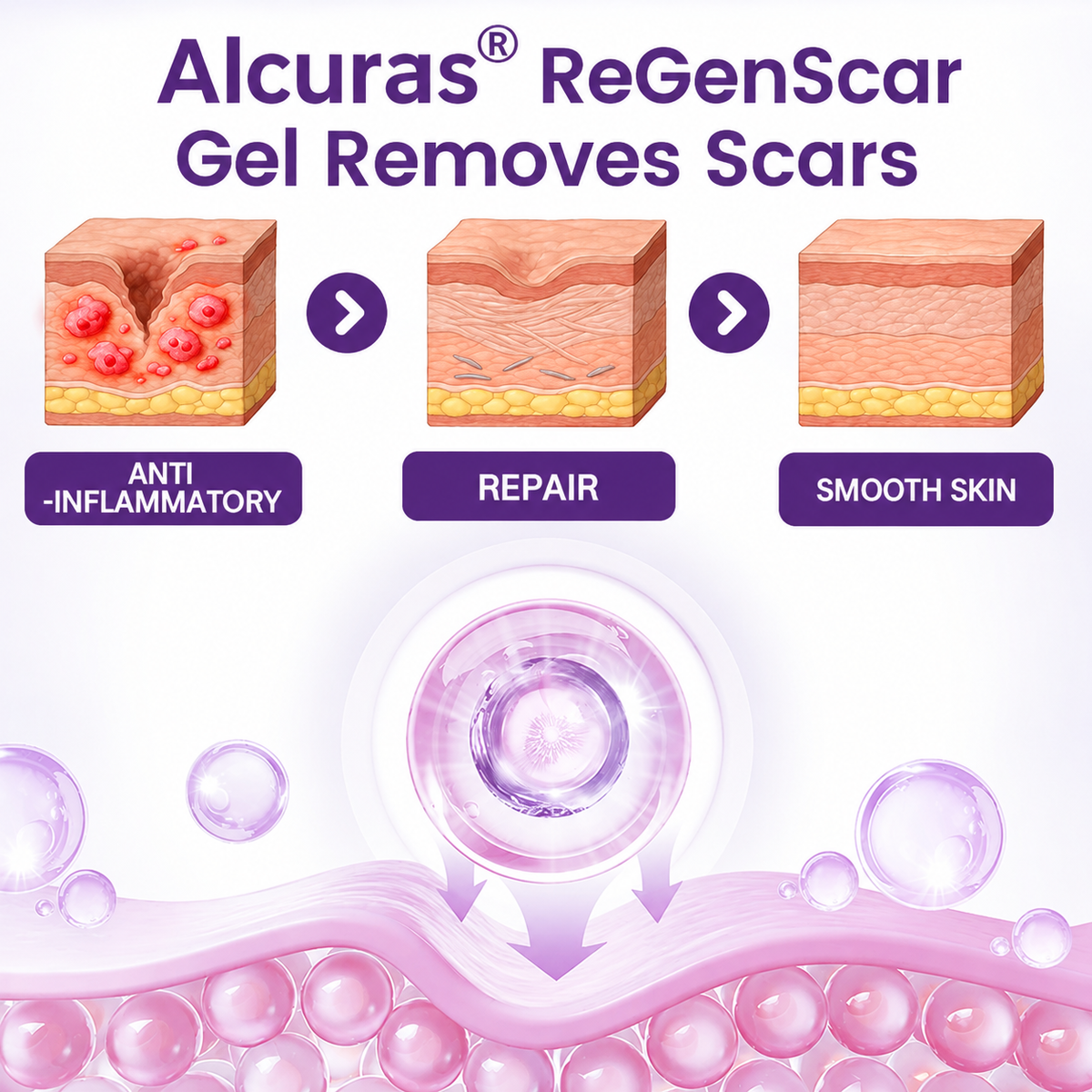 Alcuras® ReGenScar Stem Cell Scar Gel