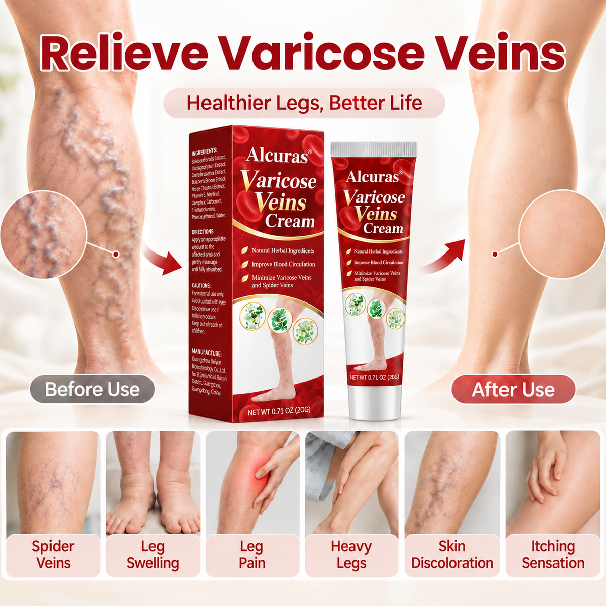Alcuras® Varicose & Spider Vein Relief Cream