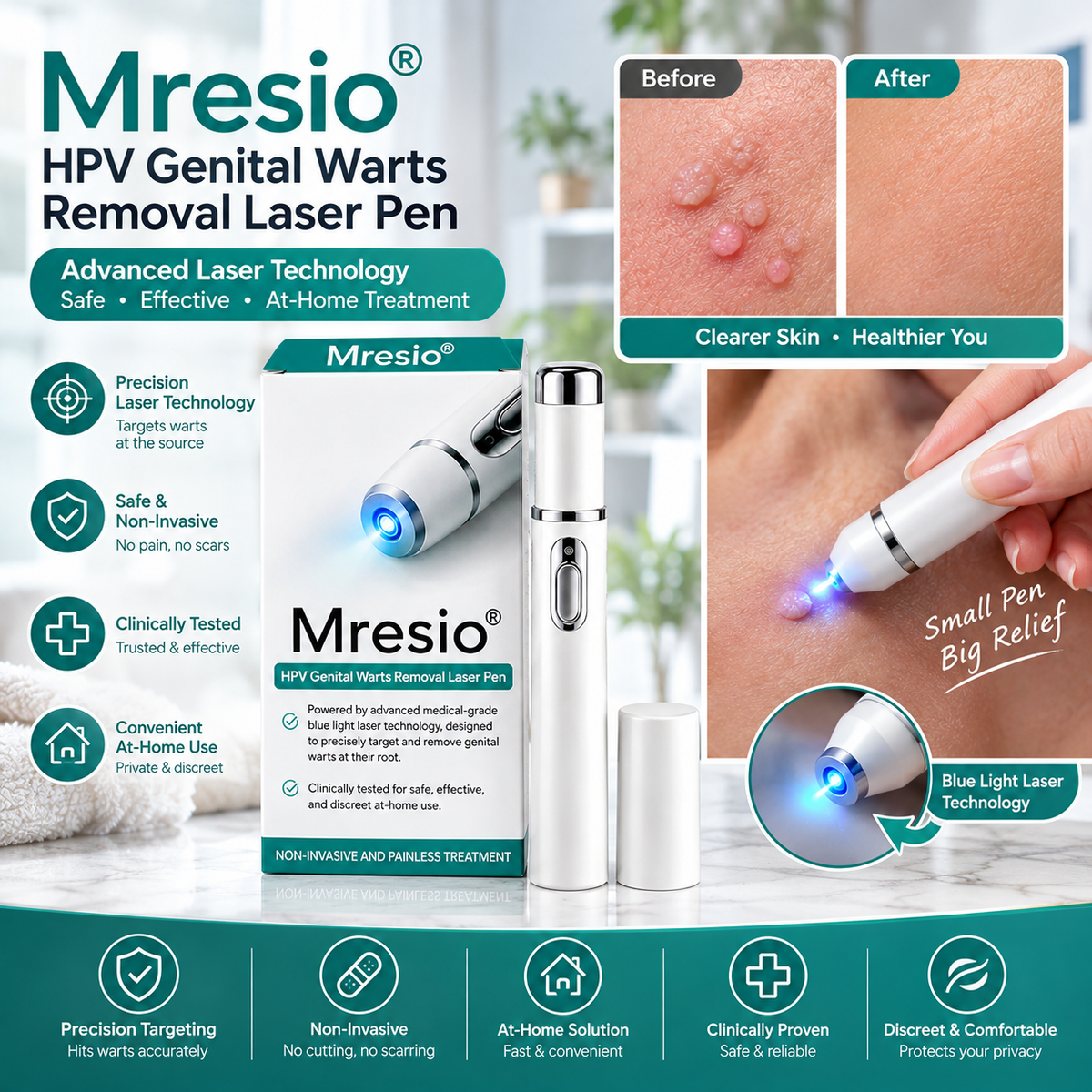 Mresio® HPV Genital Warts Removal Laser Pen