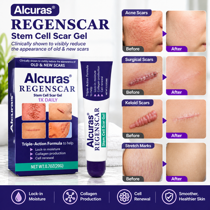 Alcuras® ReGenScar Stem Cell Scar Gel