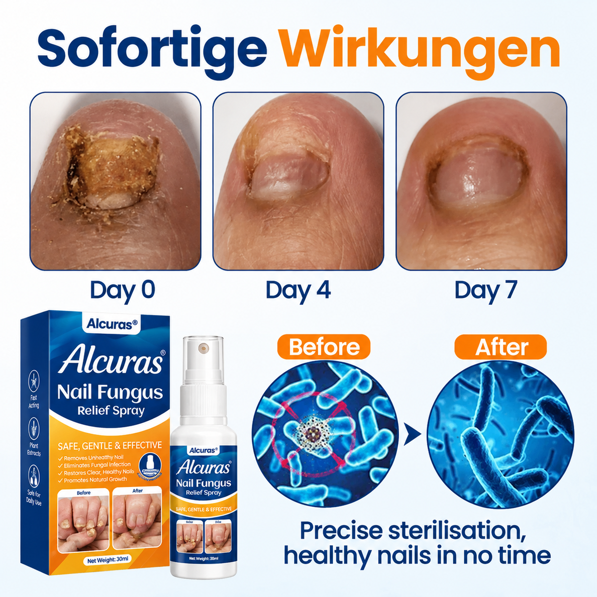 Alcuras® Nail fungus relief spray