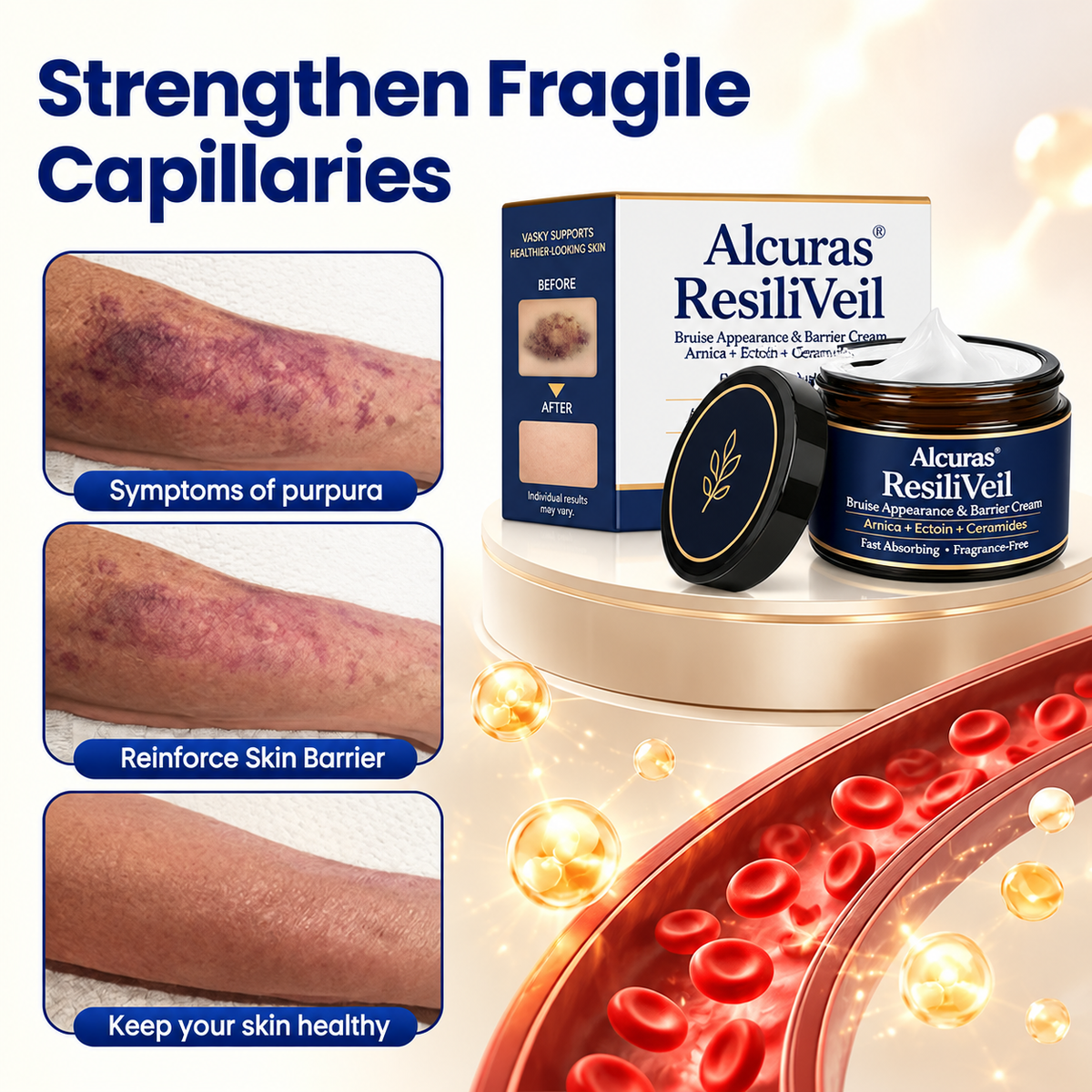 Alcuras® ResiliVeil Bruise Appearance Barrier Care Cream